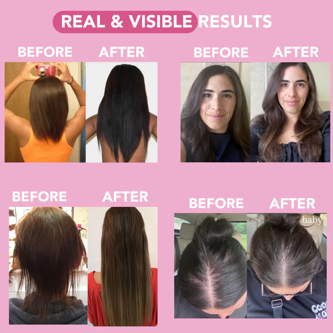 Newyuo Onion Rosemary Hair Conditioner – Scalp-Nourishing, Breakage-Reducing Formula for Fuller, Shinier Hair