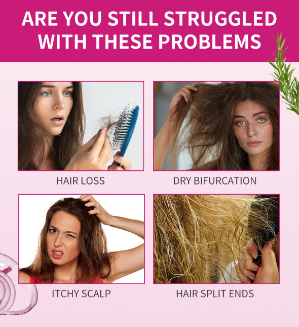 Newyuo Onion Rosemary Hair Conditioner – Scalp-Nourishing, Breakage-Reducing Formula for Fuller, Shinier Hair
