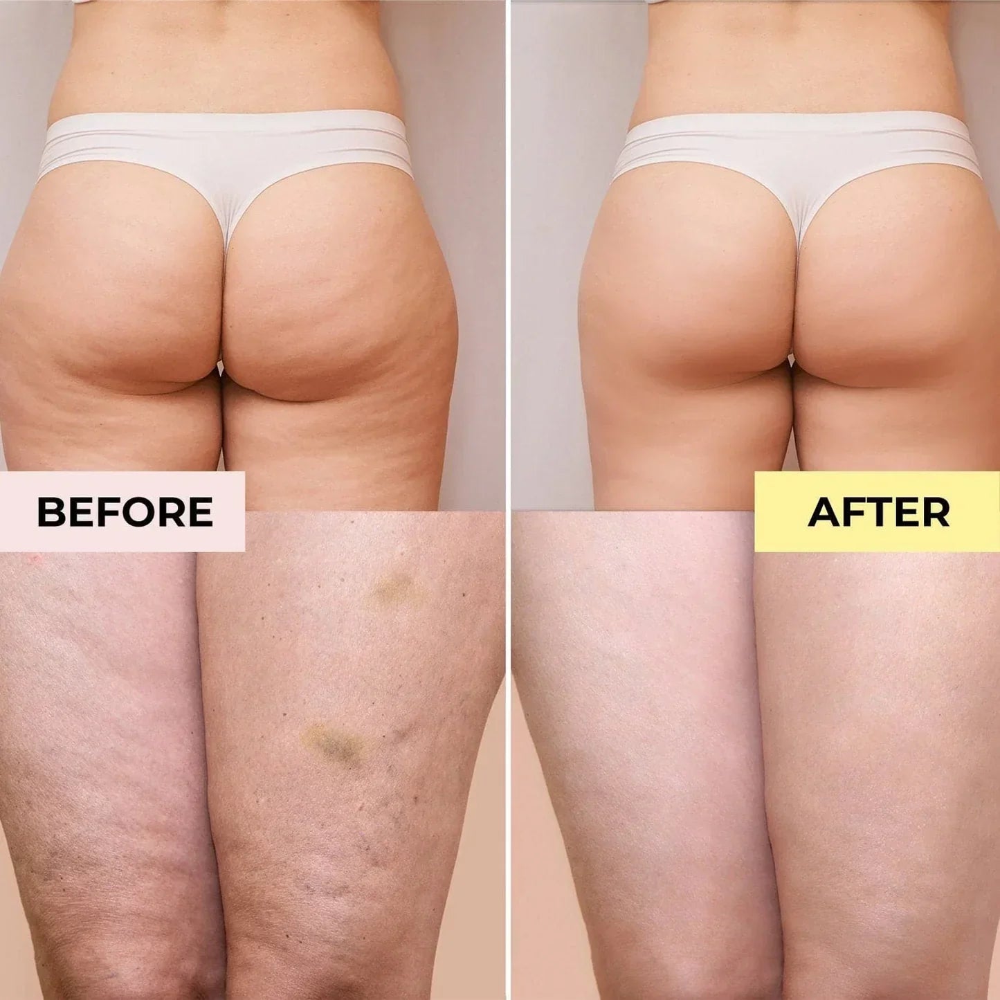 Final 3 Hours: 60%OFF🔥Naturals Cellulite Massage Oil