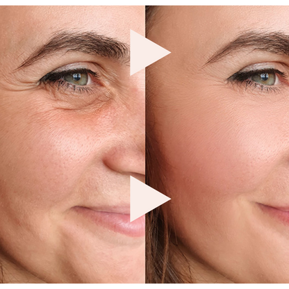Final 3 Hours: 60% OFF🔥The Express Anti-Wrinkle – Instant Lifting Effect